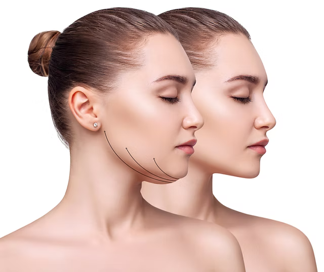 Tu mejor foto sin filtros: elimina papada y redefine tu perfil con la faja  FaceLiftPro número 1 en ventas
